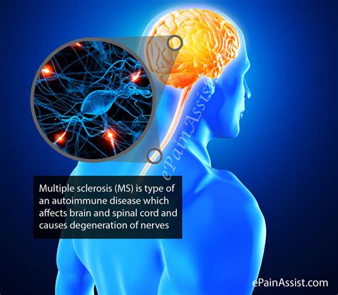 Neurological Disease Multiple Sclerosis Nursing Care Plans Safety