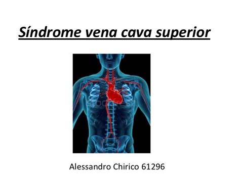 Síndrome Vena Cava Superior