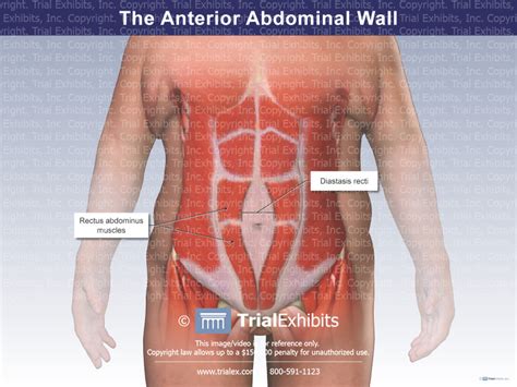 the anterior abdominal wall trial exhibits inc