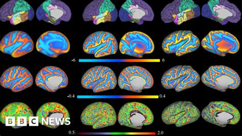 Baby Brain Scans Reveal Trillions Of Neural Connections Bbc News