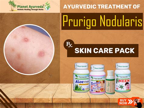 Treatment Of Prurigo Nodularis With Ayurveda Symptoms And Diagnosis