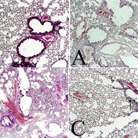 Histopathology Micrographs Of Lung Tissue From Control And Ova