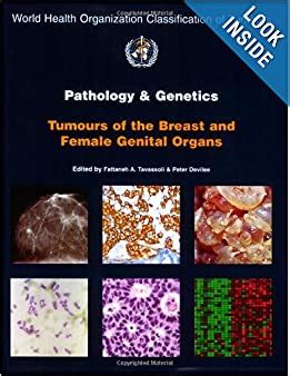 Pathology And Genetics Of Tumours Of The Breast And Female Genital