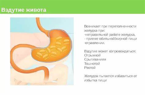 Беременная диета при вздутие живота