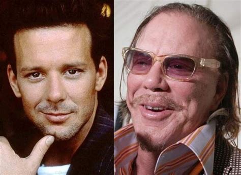 Mickey Rourke What Happened Celebrity Plastic Surgery Botox Bad