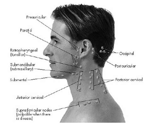 General anatomy > lymphoid system > secondary lymphoid organs > lymph node > regional lymph nodes > lymph nodes of head and neck the lymph nodes from level vi (anterior cervical node; Lymph Node Location of Head and neck | Lymph massage ...