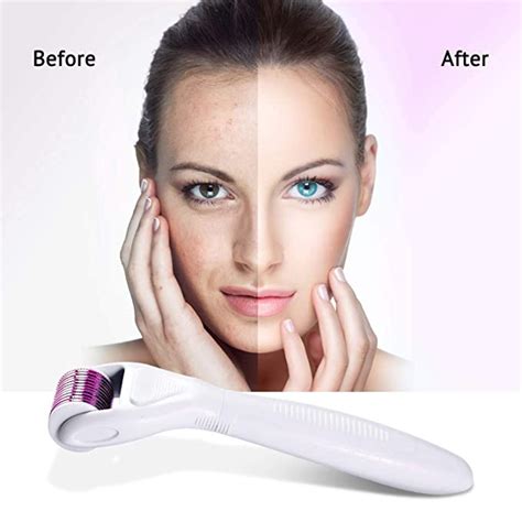 At Home Derma Roller How To Use It Urban Body Laser Vancouver