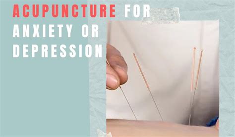 Acupuncture Massage Clinic Scarborough 10 Reasons To Consider