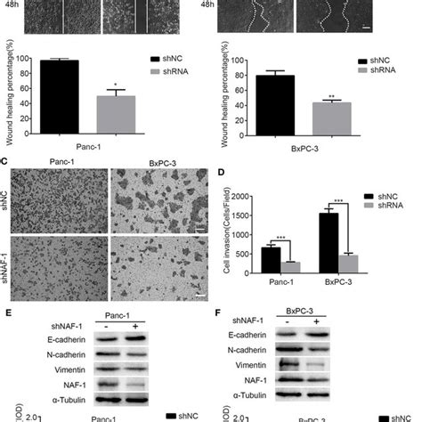 Resveratrol Inhibits The Invasion And The Migration Of Pancreatic