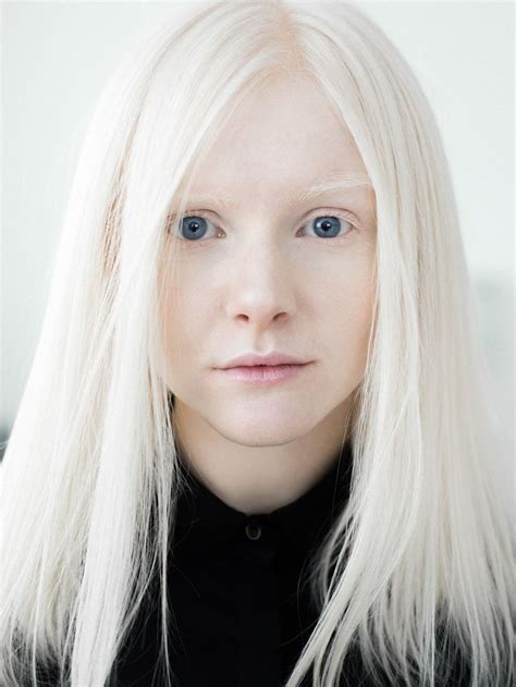 Albino Girl White Blonde Hair Albino Model