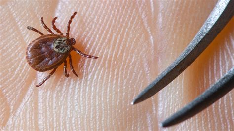 How To Avoid Tick Bites While Outdoors In Illinois Officials Nbc Chicago