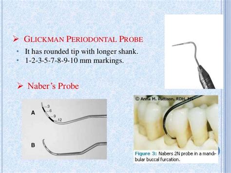 periodontal probes