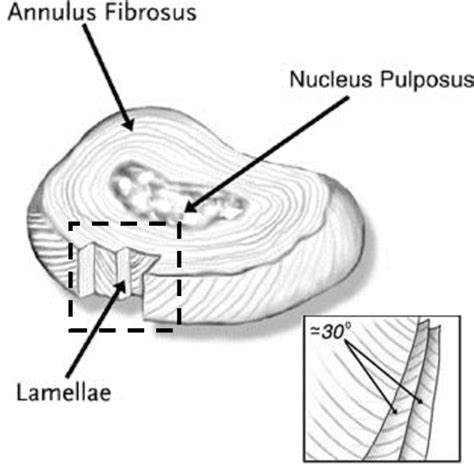Figure 3 From The Development Of A Biomimetic Patch For Annulus