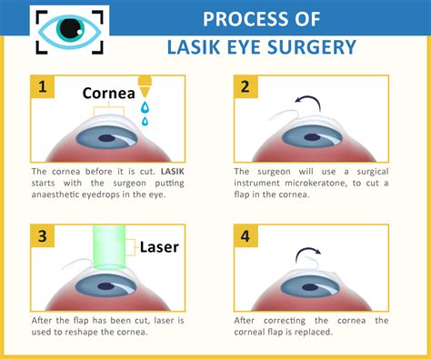 Lasik eye surgery is the best known and most commonly performed laser refractive surgery to correct vision problems. Is lasik covered by insurance - insurance