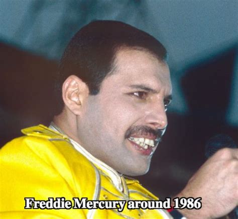 Freddie Mercury Teeth Did They Help Queen Latest Plastic Surgery