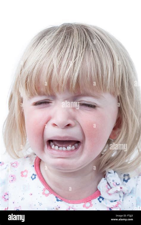 A Crying Teething Baby Girl With Red Swollen Cheeks Stock Photo Alamy