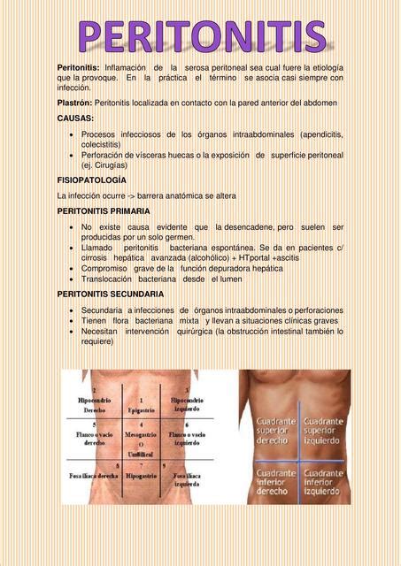 Peritonitis Salud Apuntes De Medicina Udocz