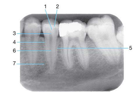 Radiology Chapter Recognizing Normal Radiographic Anatomy