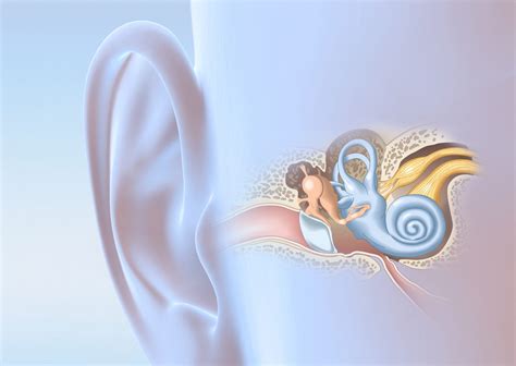 Hidden Hearing Loss A 10 Year Journey Focus A Health Blog From