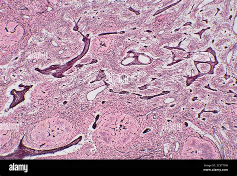 Detail Images Of Lymph Node Microscope View Stock Photo Alamy