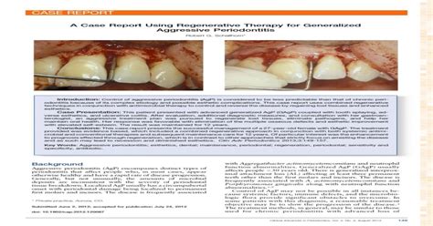 A Case Report Using Regenerative Therapy For Generalized Aggressive