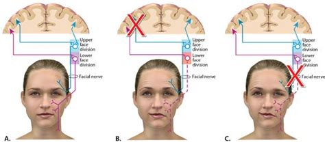 37 years experience ent and no: 17 Best images about Neuro on Pinterest | Pathways, Search ...