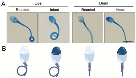 Chapter 10 Capacitation And Acrosome Reaction Histochemical Techniques To Determine Acrosome