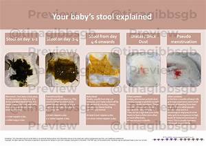 Your Baby 39 S Stool Handout Tina Gibbs Perinatal Education