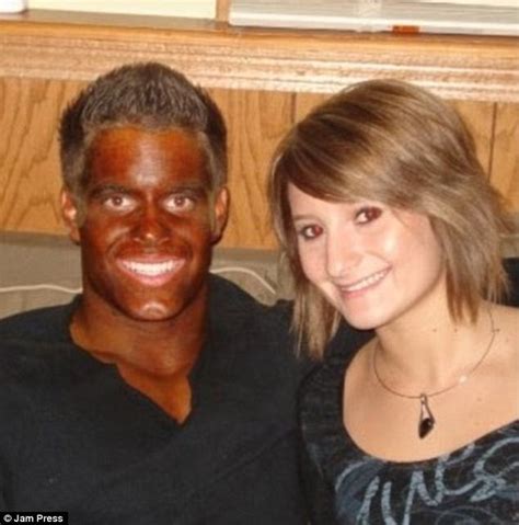 Funny Pictures Show The Most Epic Tan Fails From Sunbeds Daily Mail Online