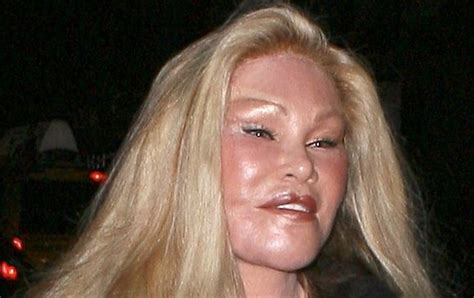 Plastic Surgery Disaster Photos Images All Disaster Msimagesorg