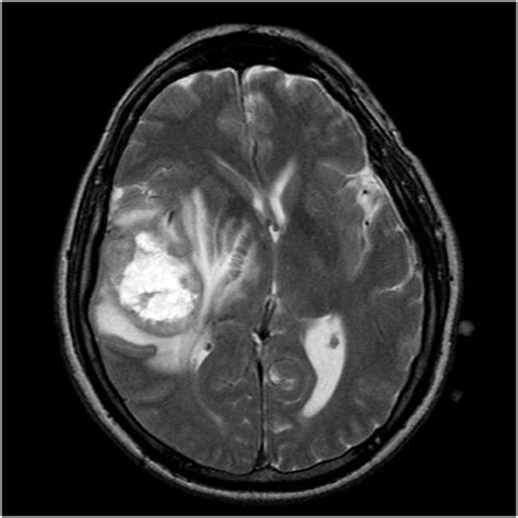 A Collection Of Surgical Pathology Images