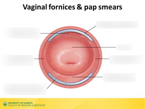 Lec Vaginal Fornices And Pap Smears Diagram Quizlet