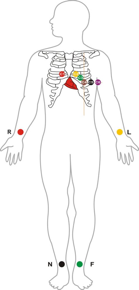 Ecg Limb Lead Placement