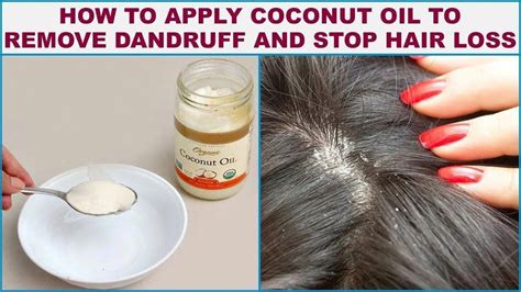 After showering, run the coconut oil through the ends of your hair, or take it up slightly higher (to the midsection of your hair) to use as a moisturizing detangler. How To Apply Coconut Oil To Remove Dandruff And Stop Hair ...