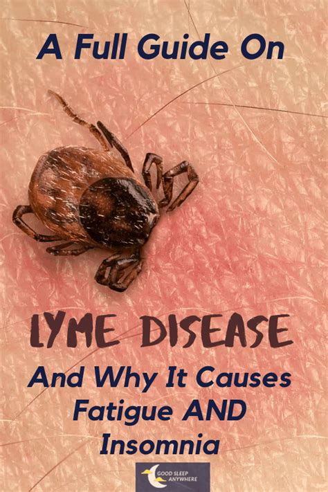 A Full Guide On Lyme Disease And Why It Causes Fatigue And Insomnia