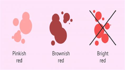 Implantation Bleeding Signs Implantation Bleeding Calculator