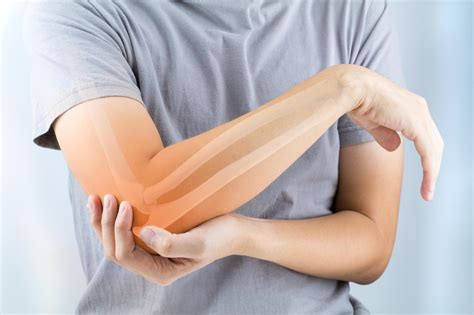 Elbow Injuries Elbow Disorders Medlineplus