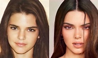 La evolución de Kendall Jenner, antes y después de la fama (Fotos ...