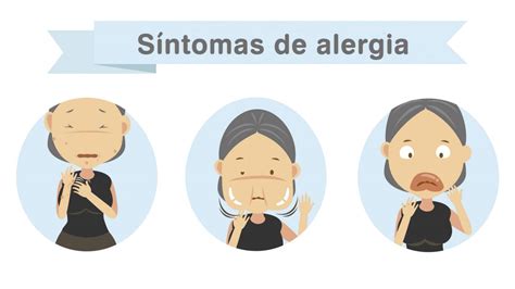 5 Síntomas De Alergia Alimentaria Hogarmania