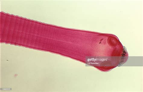 Photomicrograph Of Tapeworm Formed Below Neck 10x High Res Stock Photo