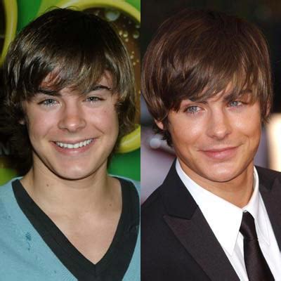 Zac Efron Plastic Surgery Before And After Nose Jobs Plastic Surgery