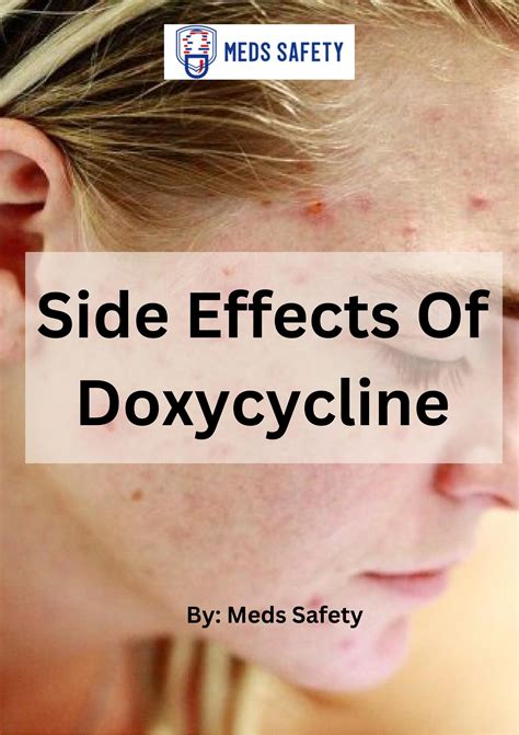 Side Effects Of Doxycycline By Meds Safety Issuu