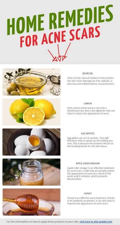 Homemade Remedies For Pimples Best Acne Treatments Guide Natural