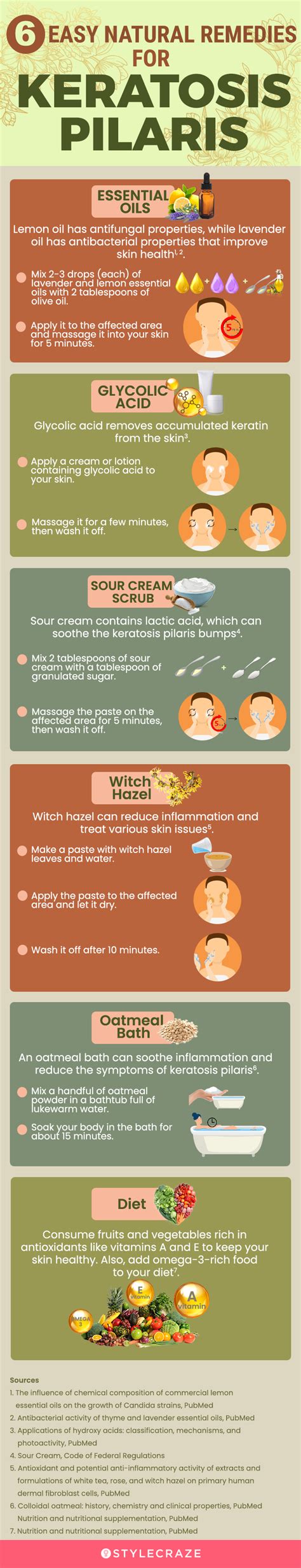 14 Effective Home Remedies For Treating Keratosis Pilaris