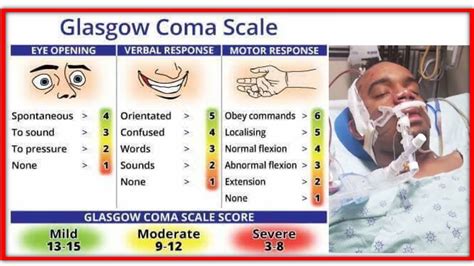 Easy Way To Learn Glasgow Coma Scale How To Learn Glasgow Coma Scale Glasgow Coma Scale