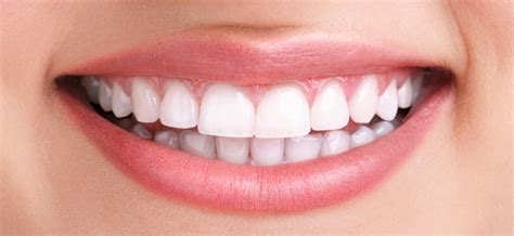 Teeth Cleaning And Teeth Whitening Preventive Care Tips