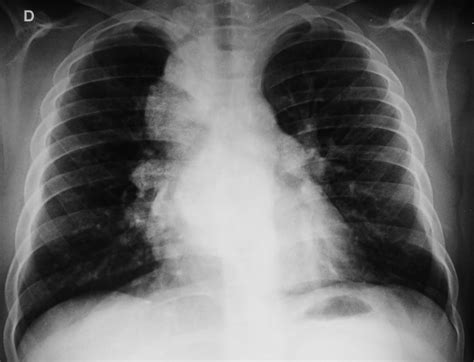 Best Radiology Cases
