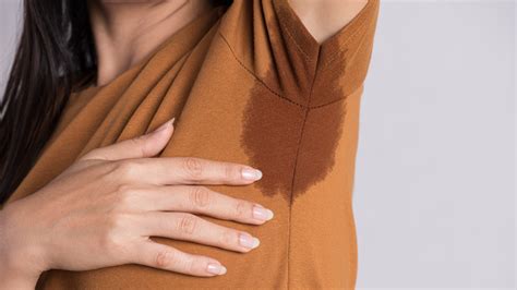 Heres How You Can Treat Hyperhidrosis