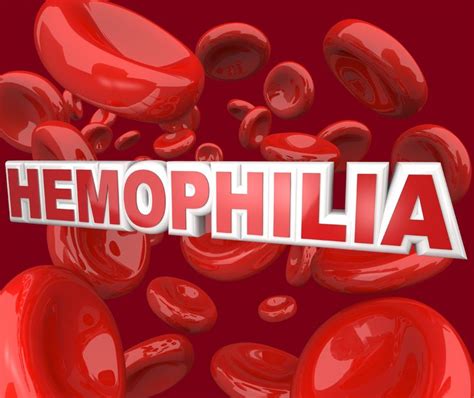 Leer de symptomen, definitie, oorzaken, behandeling en test. Hemophilia | Health&Fitness Talk