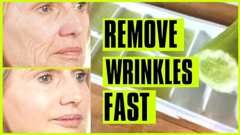 Smart Trick To Rapidly Remove Wrinkles And Fine Lines On Face Very Fast Youtube